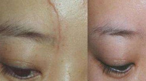 西京醫(yī)院美容科的醫(yī)師團(tuán)隊(duì)與隆鼻優(yōu)質(zhì)服務(wù)如何？