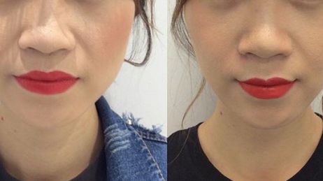 2023年熱議：揭秘重慶市當(dāng)?shù)貥O具口碑的整容醫(yī)院！