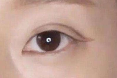 上海九院植發(fā)醫(yī)生劉清簡(jiǎn)介，用心解讀醫(yī)生信息！總結(jié)速查：上海九院植發(fā)醫(yī)師劉清，醫(yī)術(shù)高超！