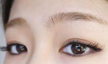 浙二醫(yī)院整形科包祺雙眼皮效果如何？專家簡介及成功案例分享