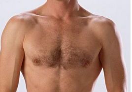 成都整容醫(yī)生吳開泉鼻部整形手術(shù)真實案例！