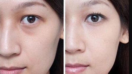 哪家醫(yī)院在大連揚名于胸部整形？