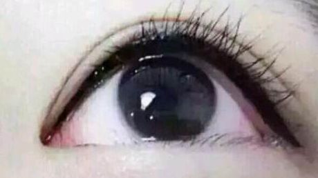 深圳哪家醫(yī)院割雙眼皮效果更好？值得推薦！