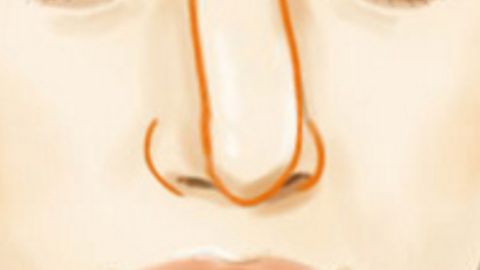 南京私密整形——關于這個你或許不知道的小秘密