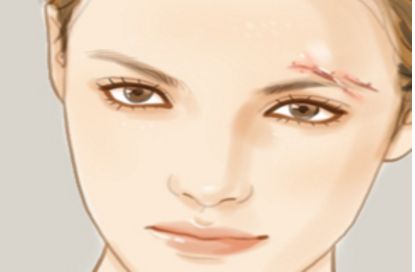 昆明熱瑪吉手術(shù)合格專家醫(yī)院匯總，想知道的小伙伴記得收藏！