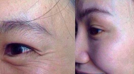 2023年度合肥整形醫(yī)院隆鼻排行榜最新發(fā)布