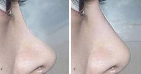 無錫最新醫(yī)美熱門！高人氣整形醫(yī)院揭秘，信譽(yù)在線！