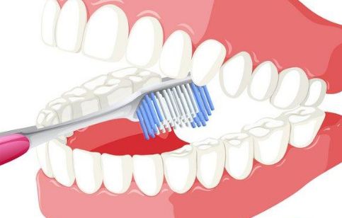 獨特魅力之李映雨隆胸歷程，魔法技藝完美呈現(xiàn)