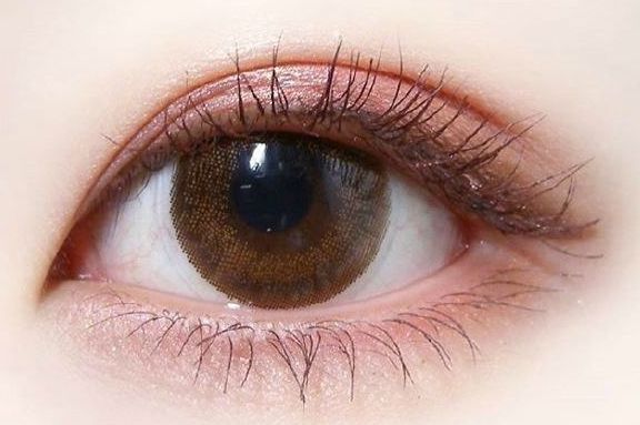 做雙眼皮的技術(shù)及效果，近年治療體驗(yàn)發(fā)布解析