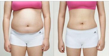 廣州優(yōu)秀整形醫(yī)院排名前三，看看美恩、荔醫(yī)、曙光的口碑如何