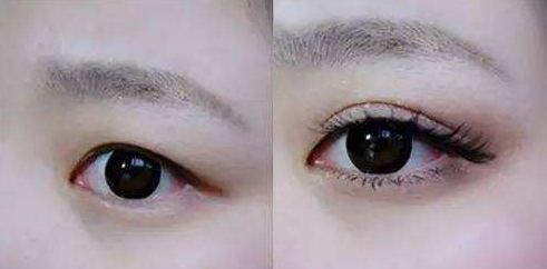 上海九院張英為雙眼皮手術(shù)的明星醫(yī)生，獨(dú)具醫(yī)術(shù)絕技。