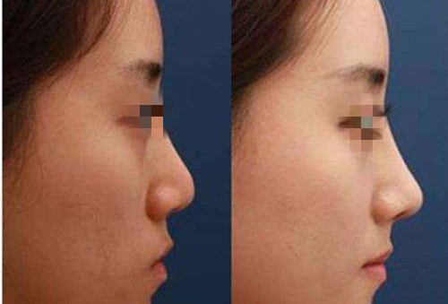 重慶愛思特整形美容醫(yī)院團(tuán)隊(duì)的技術(shù)一覽，值得信賴嗎？