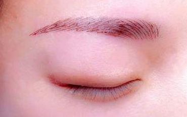 北京打玻尿酸首選！猛戳熱搜榜，解鎖姐妹們的心聲！