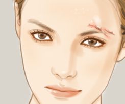 哪家醫(yī)院是國內(nèi)顴骨整形的佼佼者？九院，華西，西京等整友們贊不絕口！