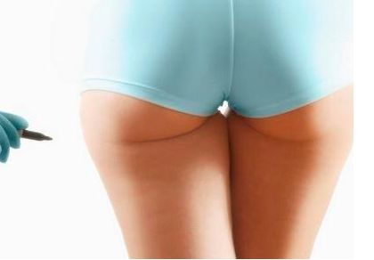 廣州權(quán)威吸脂醫(yī)院推薦，技術(shù)卓越不可錯過！