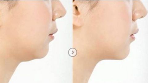 無錫哪家整形醫(yī)院正規(guī)靠譜？2023曼陀羅、伊爾美等名院是首選！