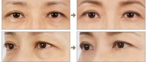 濟南省立醫(yī)院靚麗容顏新匯價，專家團陣容揭曉