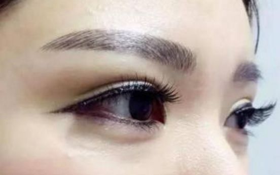 2023年最受認(rèn)可的國內(nèi)拉皮手術(shù)醫(yī)生排行榜，頂尖專家名單公布