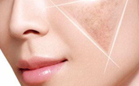 卿勇隆鼻效果如何？專家所屬醫(yī)院披露