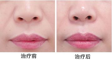 最靠譜的蘇州下頜角整形醫(yī)院推薦，口碑爆棚的醫(yī)療機(jī)構(gòu)評(píng)選