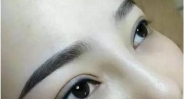 北京哪個醫(yī)院治療胎記效果好？這家醫(yī)院備受推崇