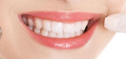 2023年一覽廈門最新雙眼皮醫(yī)療機(jī)構(gòu)-替代列表中，星系、顏王等上榜，自主選擇美容服務(wù)！