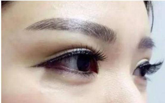 經(jīng)驗(yàn)豐富！華西地區(qū)雙眼皮重點(diǎn)醫(yī)生推薦，名單揭秘！