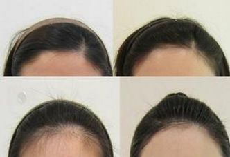 上海久愿整形醫(yī)院：醫(yī)術(shù)高超的專家團(tuán)隊(duì)及服務(wù)費(fèi)用展示