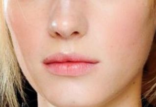 鄭州二附院馬富廉醫(yī)院特點揭秘！下頜角磨骨案例詳解！