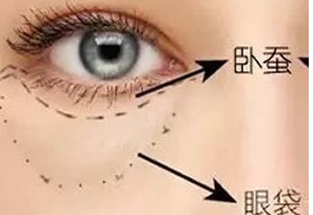 北京協(xié)和醫(yī)院隆胸案例與醫(yī)生簡介含金量如何？收費(fèi)是否合理？