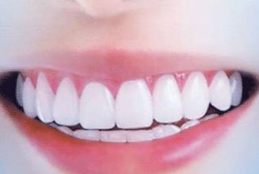 蘇州市立醫(yī)院整形科是否分布在不同的院區(qū)？蘇州市立醫(yī)院整形科在哪些院區(qū)開(kāi)設(shè)？