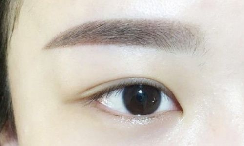 高水準醫(yī)生為您解密寧波楊加峰雙眼皮術的案例與技術！