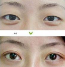 成都哪些醫(yī)生能力出眾進(jìn)行隆胸術(shù)？年度隆胸好醫(yī)生十大排名出爐