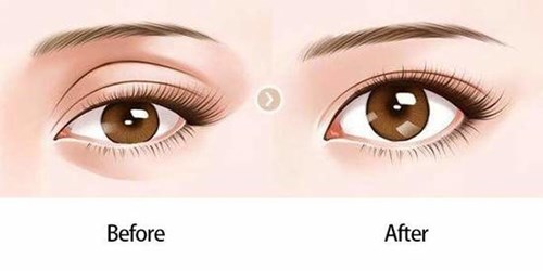 邯鄲哪家醫(yī)院能夠有效改善厚唇問題？如何選擇醫(yī)院？