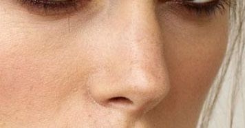 西安哪家醫(yī)院治療雙眼皮效果專業(yè)？達(dá)人推薦，好口碑！