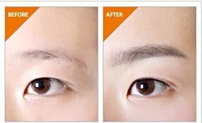 華西醫(yī)院整形外科靠譜嗎？手術費用和?？凭ǖ目剖矣心男? style=