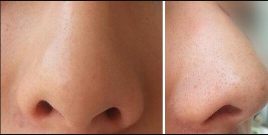 上海九院整形科怎么掛號預(yù)約？只需簡單幾步，輕松解決！