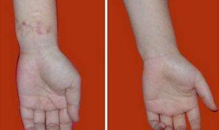 重慶暢美吸脂減肥醫(yī)院：革新技術引領行業(yè)，成就完美曲線