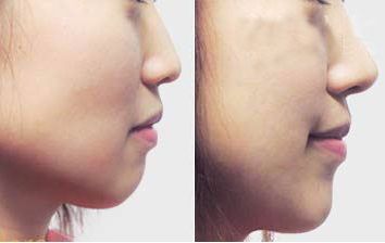 珠海采用新技術(shù)，瞬間消除黑眼圈的專業(yè)美容醫(yī)院預(yù)約