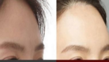 廈門(mén)哪些醫(yī)院擁有的抽脂技術(shù)，等你來(lái)發(fā)現(xiàn)