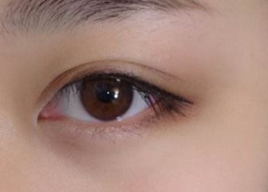 重慶2023年雙眼皮醫(yī)生：吳小樓、曹陽(yáng)、何勝旗醫(yī)術(shù)對(duì)比