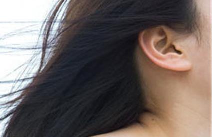 切眉后消腫需要多久才能恢復(fù)正常？需要注意哪些事項(xiàng)來促進(jìn)消腫？