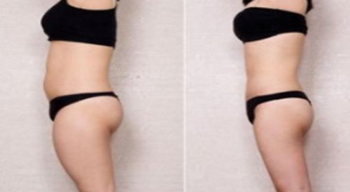 杭州首屈一指的美容整形醫(yī)院排行榜：曝光前十佼佼者