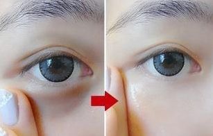 鄭州恩喜整形醫(yī)院：持續(xù)80天逐漸呈現(xiàn)完美隆鼻效果的揭秘