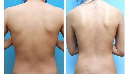 2023年長(zhǎng)沙地區(qū)推薦的面部拉皮除皺醫(yī)生排行榜公開醫(yī)生背景介紹詳細(xì)版