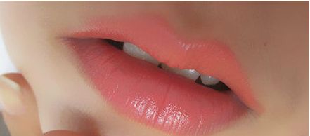 秦皇島頂級(jí)醫(yī)院一次雙眼皮手術(shù)價(jià)格揭秘，專家推薦+真實(shí)案例告訴你！