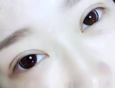 探秘秦皇島醫(yī)療機(jī)構(gòu)，深度了解雙眼皮手術(shù)的影響及推薦醫(yī)生星級！