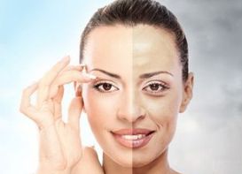 浙大四院整形科的專家介紹、收費(fèi)價(jià)目表以及一個(gè)令人驚嘆的隆鼻案例