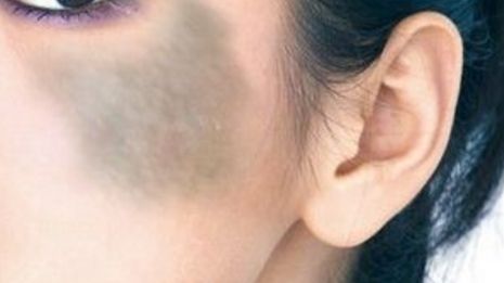 鎮(zhèn)江隆鼻醫(yī)院推薦：鎮(zhèn)江做隆鼻，這幾家醫(yī)院不可錯(cuò)過！