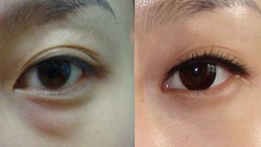 廣州哪家整形醫(yī)院最受好評(píng)？TOP3推薦！